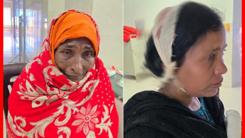 গোদাগাড়ীতে মাদক টাকা না পেয়ে মা ও বোনের মাথা ফাটালেন মাদকাসক্ত যুবক