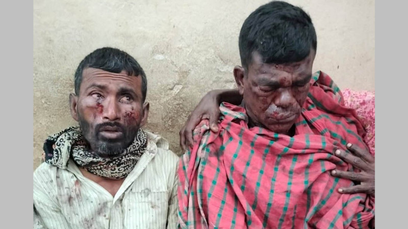 বেনাপোলের বালুন্ডায় পুঁতে রাখা বোমা বিস্ফোরণে তিন শ্রমিক আহত, দুজনের অবস্থা আশঙ্কাজনক
