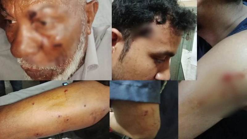 কুষ্টিয়ার পদ্মা নদীতে গুলাগুলিতে ৫ পুলিশ গুলিবিদ্ধ