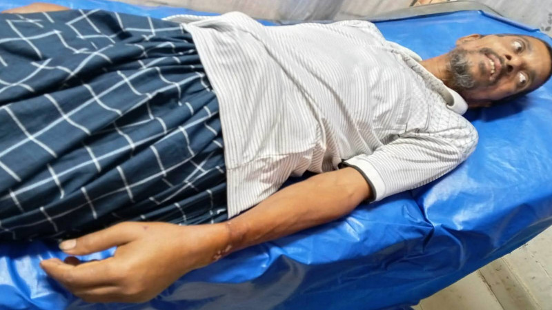আক্কেলপুরে সেচ পাম্পের মালিককে মারধর করে ৩টি ট্রান্সফরমারের কয়েল চুরি