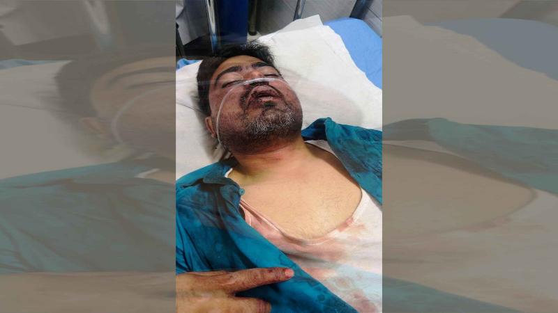 কৃষি ব্যাংকের ম্যানেজারকে অপহরণ হাতুরি দিয়ে পিটিয়ে মুক্তিপণ আদায়