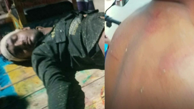 তানোরে তুচ্ছ ঘটনায় হত্যার উদ্দেশ্যে দেশীয় অস্ত্র দিয়ে হামলা