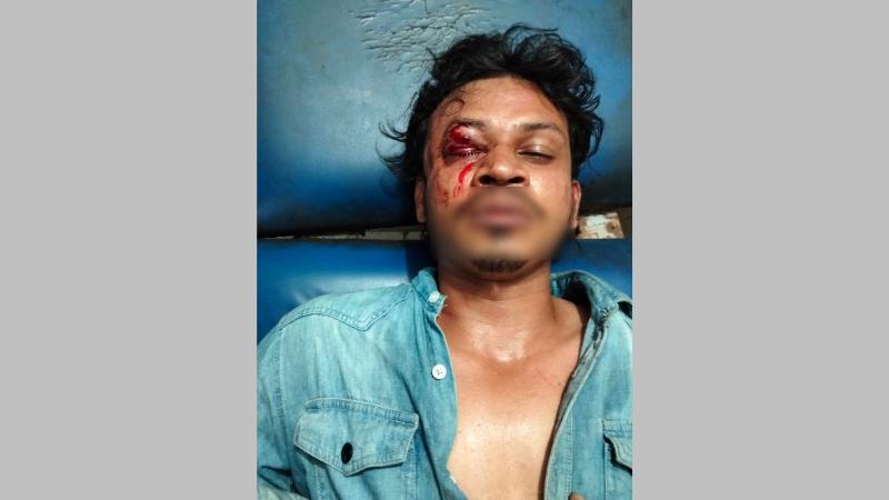 রাণীশংকৈলে ফুচকা হাউজে অসামাজিক কাজের প্রতিবাদ করায় যুবককে কুপিয়ে জখম-থানায় অভিযোগ