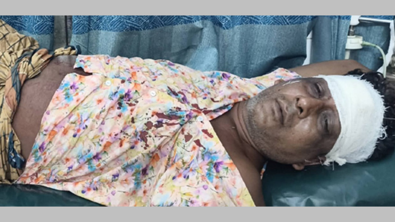 খুলনার রূপসায় সন্ত্রাসীর গুলিতে বিএনপি নেতা সাইনুর শেখ রক্তাক্ত জখম