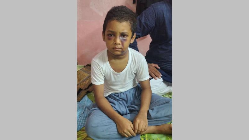 খুলনা নগরীরতে মাদ্রাসা শিক্ষকের বেত্রাঘাতে ৯ বছরের শিশুর মস্তিষ্কে রক্তক্ষরণ