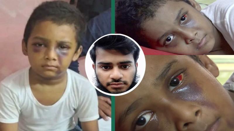 শিশু ইসমাইলকে বেত দিয়ে অত্যন্ত নিষ্ঠুর ভাবে মারধরের ঘটনায় সোনাডাঙ্গা থানায় মামলা