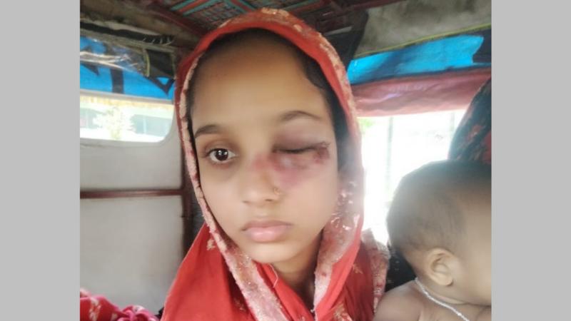 উলিপুরে কিশোর গ্যাং এর তান্ডবে চোখের দৃষ্টি হারাতে বসেছে এক গৃহবধু