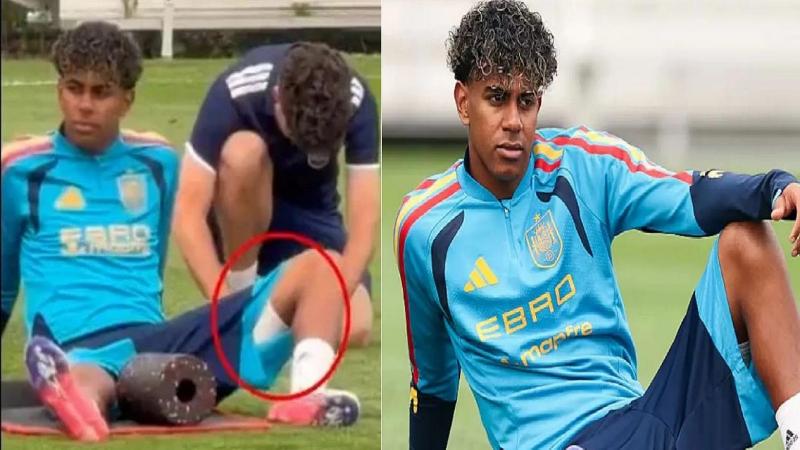 ফাইনালের আগে স্পেন শিবিরে বাড়ছে দুশ্চিন্তা!