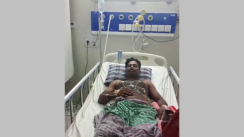 কুষ্টিয়ায় সাপের কামড়ে হাসপাতালে সাপুড়ে ইমরান