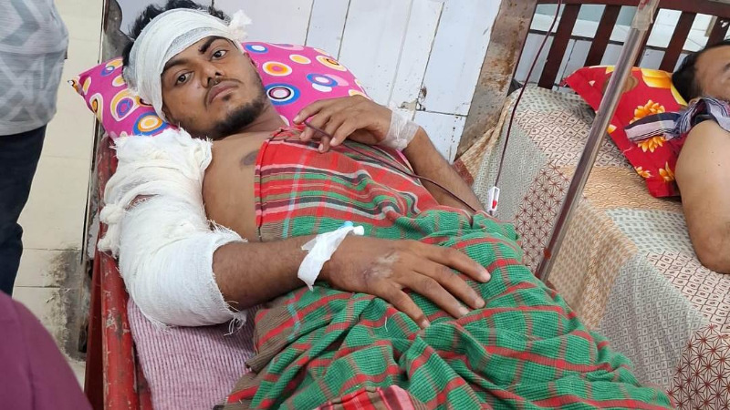 চাঁদপুরের মতলবে প্রকাশ্যে যুবককে কুপিয়ে হত্যাচেষ্টায় পা হারানোর শঙ্কা