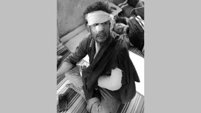 যশোর বেনাপোলে পারিবারিক কলহের জেরে ভাইকে কুপিয়ে জখম