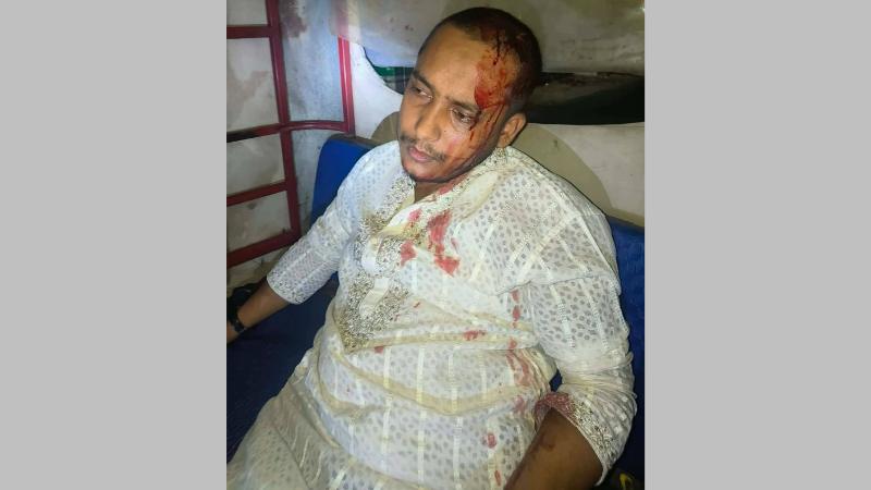তানোরে এনসিপি নেতাকে কুপিয়ে জখম