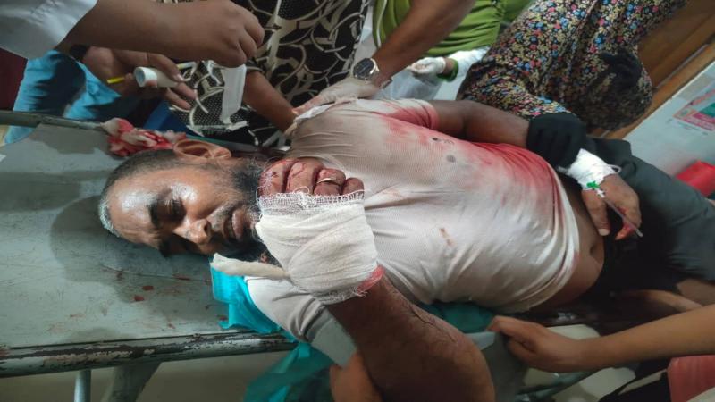 সিরাজগঞ্জে জামায়াত নেতার ওপর হামলায় বিএনপি নেতাকর্মীদের বিরুদ্ধে মামলা